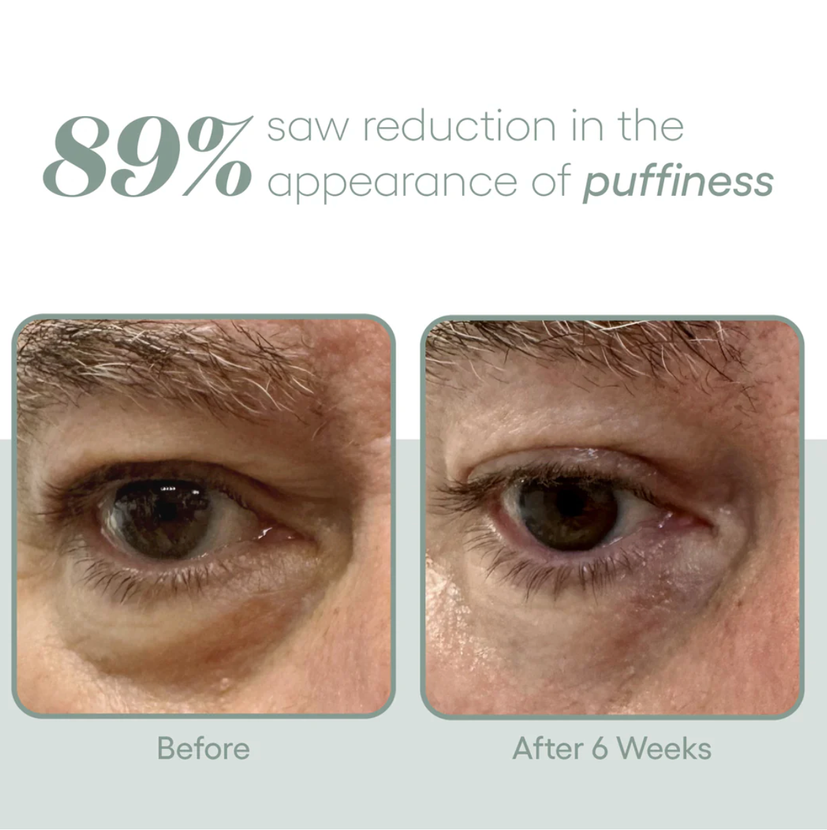 (plated) Eye Serum